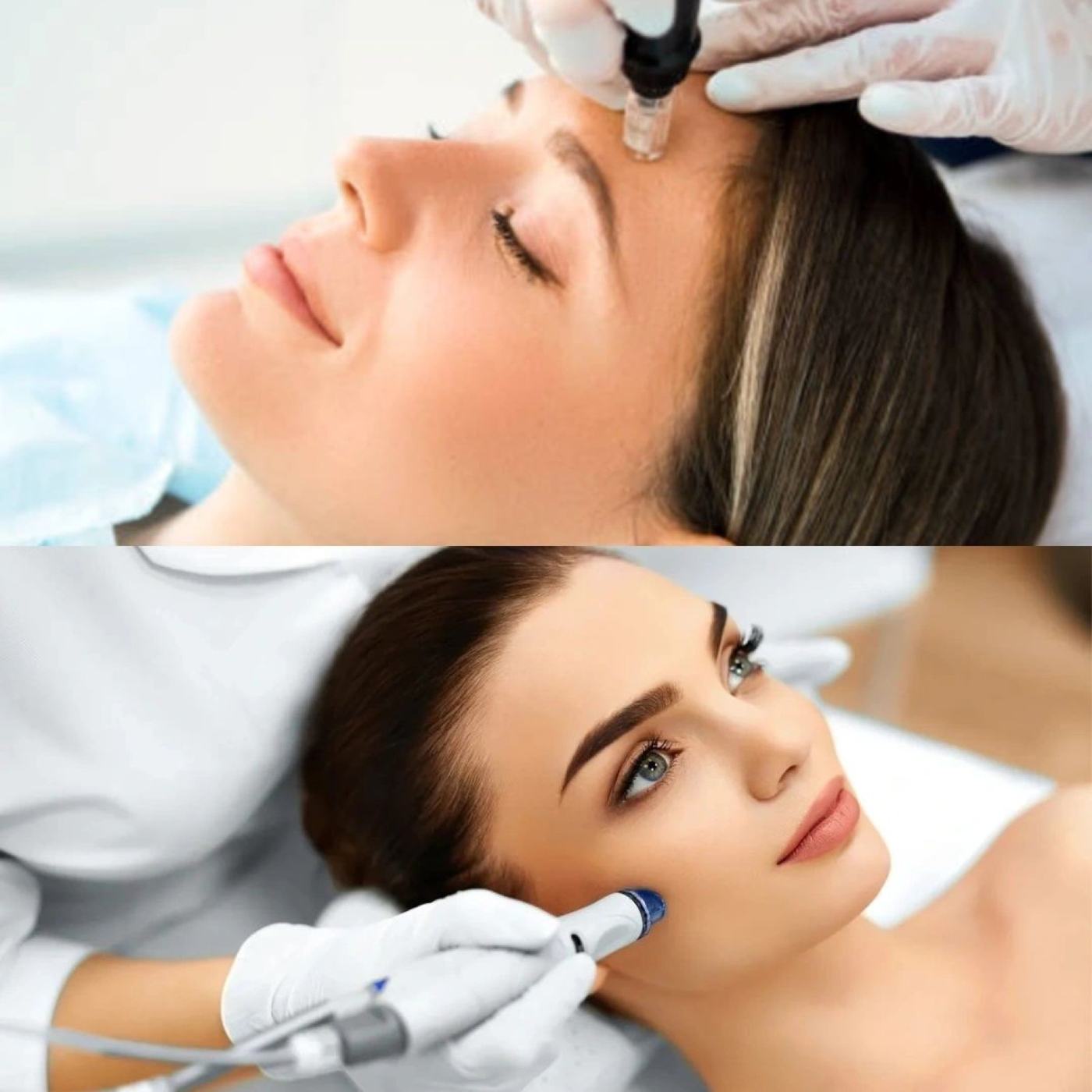 Aquafacial und Microneedling Behandlung